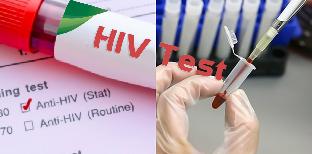 HIV/AIDS 16 dấu hiệu nhiễm bệnh cần biết - TRUNG TÂM XÉT NGHIỆM Y KHOA LIFE